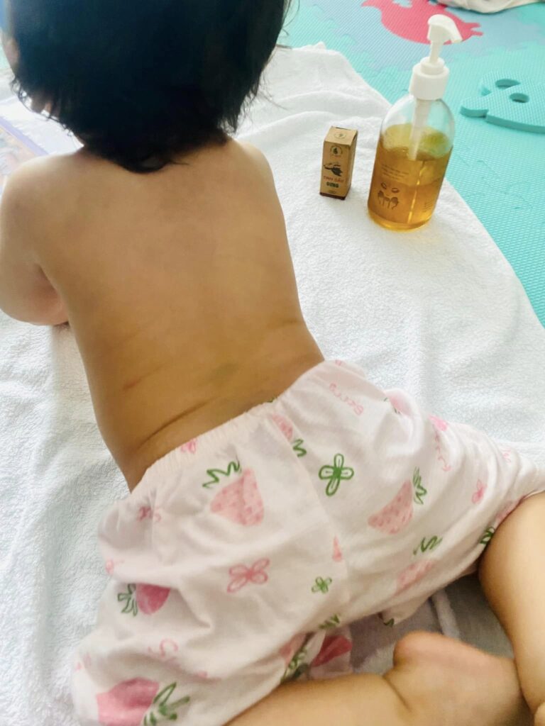 massage dau me den 02