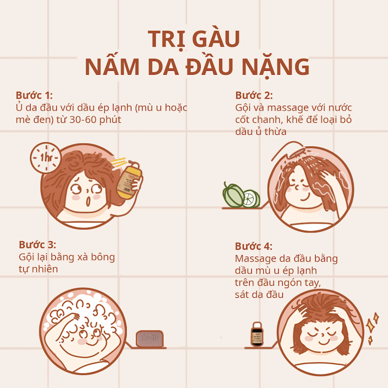 Dầu gội trị gàu và trị nấm da đầu nặng