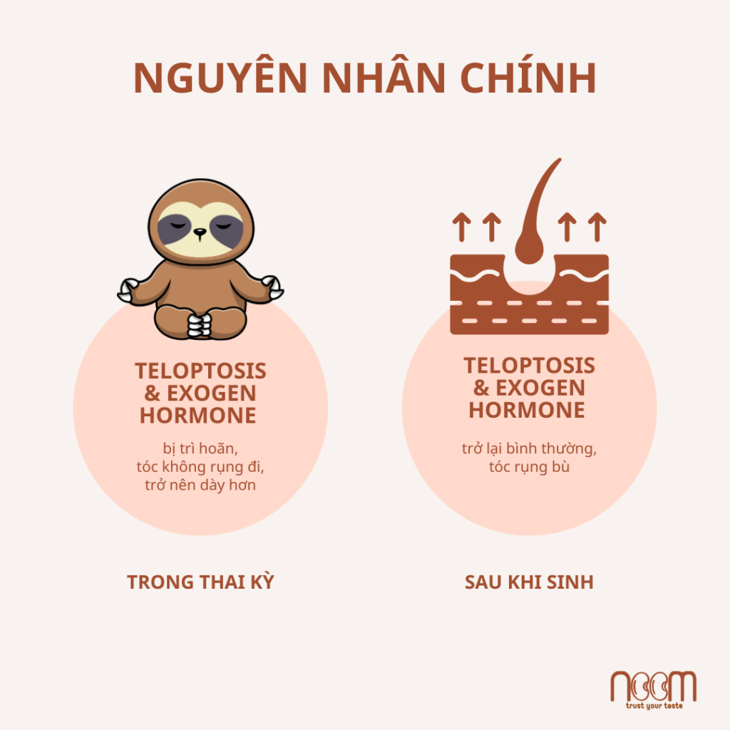 nguyên nhân gây rụng tóc sau sinh