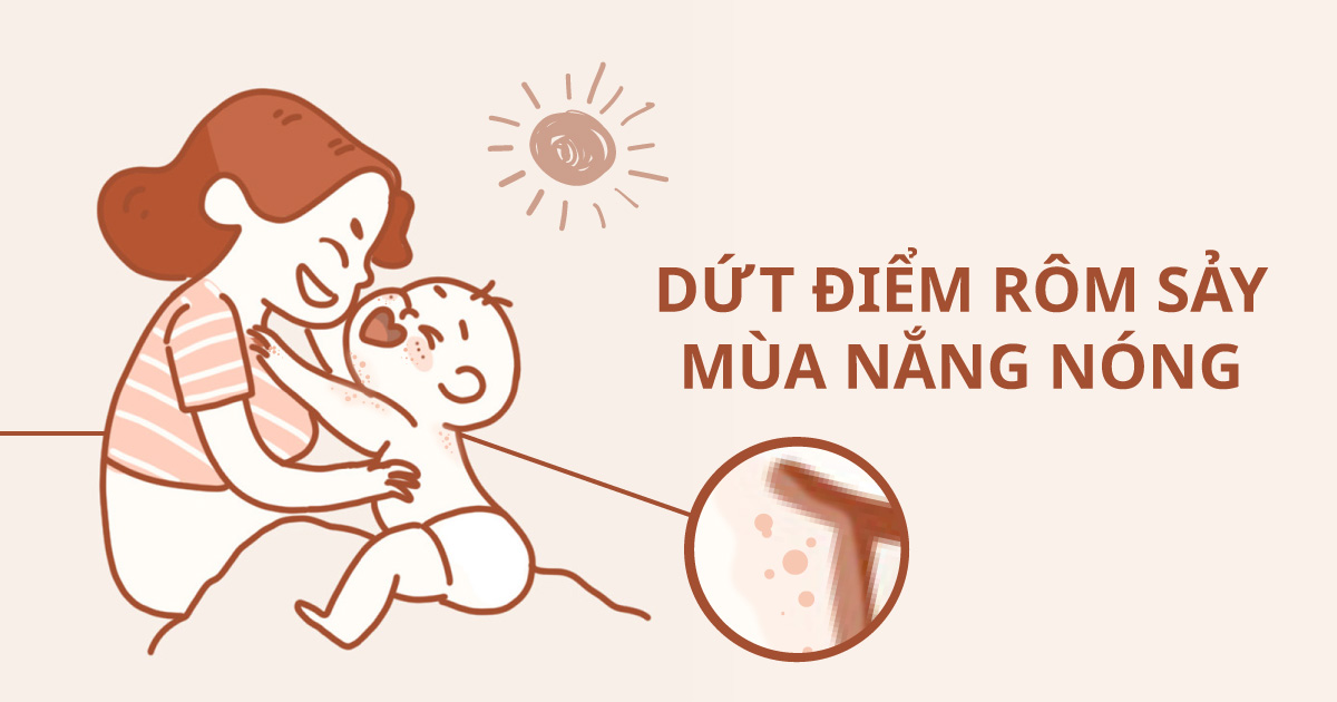 Rôm Sảy Ở Trẻ – 7 Cách Chữa Bệnh Không Dùng Thuốc 1 rôm sảy ở trẻ