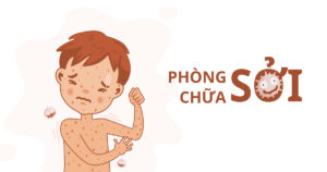 noom cach phong chong benh soi 210325